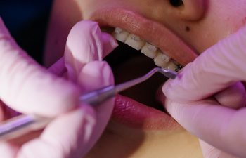 Dental Health: What Foods Should You Avoid to Keep Your Teeth Healthy?