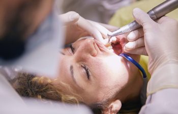When Can a Smile Makeover Be Beneficial?