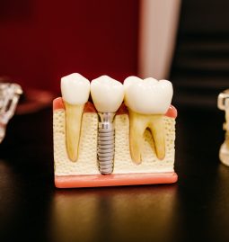 How Does Dental Checkup Needs Change with Age?