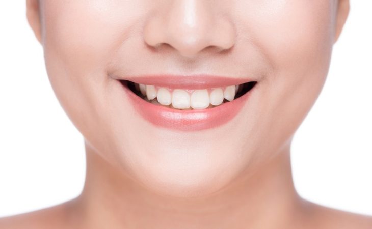 Why Should I Consider Dental Implants?