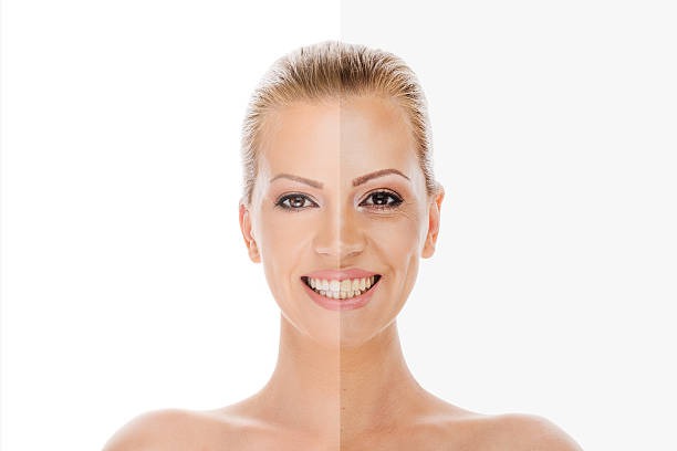 Common Misconceptions About Cosmetic Dentistry Debunked